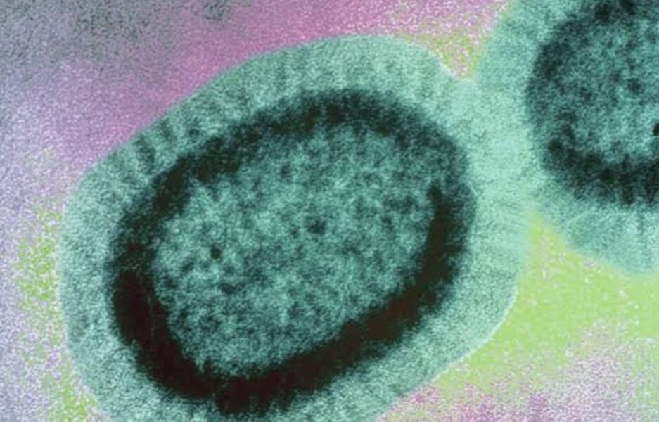 nipah virus