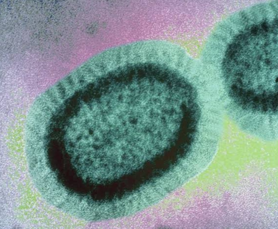 nipah virus